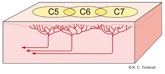 Overlap between dermatomes